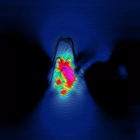 Screenshot of MDS Flex platform run data showing a Complex Corrosion feature from a pipeline inspection